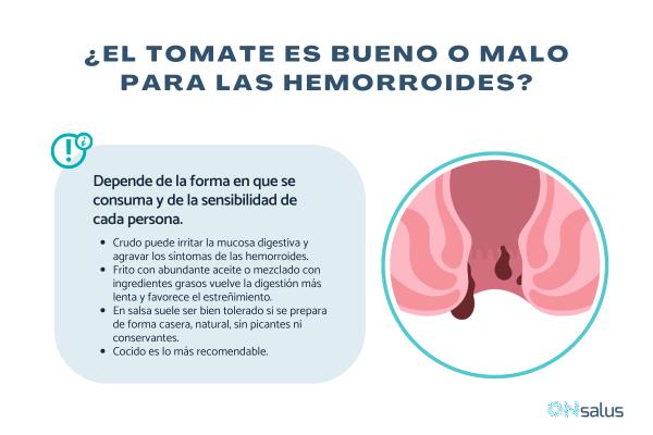 ¿El tomate es malo para las hemorroides?