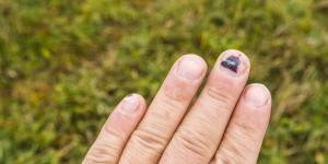 Por qué se ponen las uñas moradas