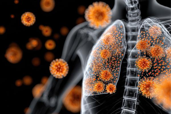 Clindamicina: para qué sirve, dosis, presentaciones y efectos secundarios - ¿Para qué sirve la Clindamicina?