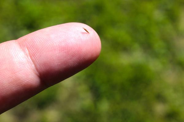 Cómo sacar una astilla del dedo