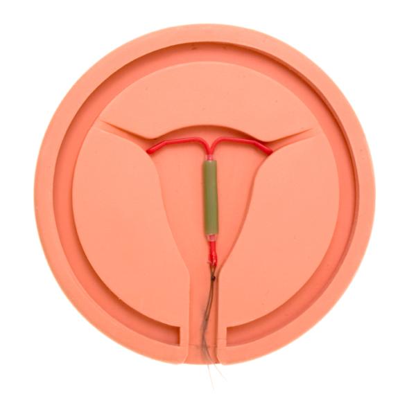 Métodos anticonceptivos más eficaces - Dispositivo intrauterino (DIU)