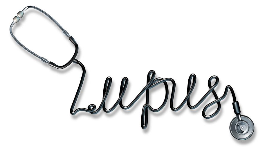 El Lupus Es Una Enfermedad Mortal