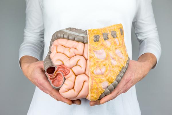 Colitis nerviosa: causas, síntomas y tratamiento - Colitis: ¿Qué es?