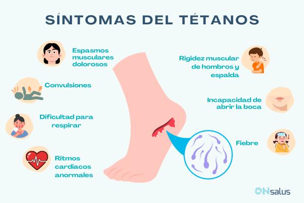 Conoce los síntomas del tétanos: guía completa para identificarlos a tiempo y saber cuándo acudir al médico