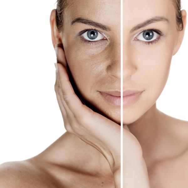 Limpieza de cutis en casa con productos naturales - paso a paso - Beneficios de la limpieza de cutis