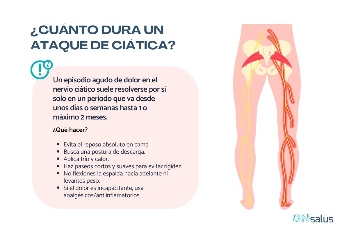 ¿Cuánto dura un ataque de ciática?