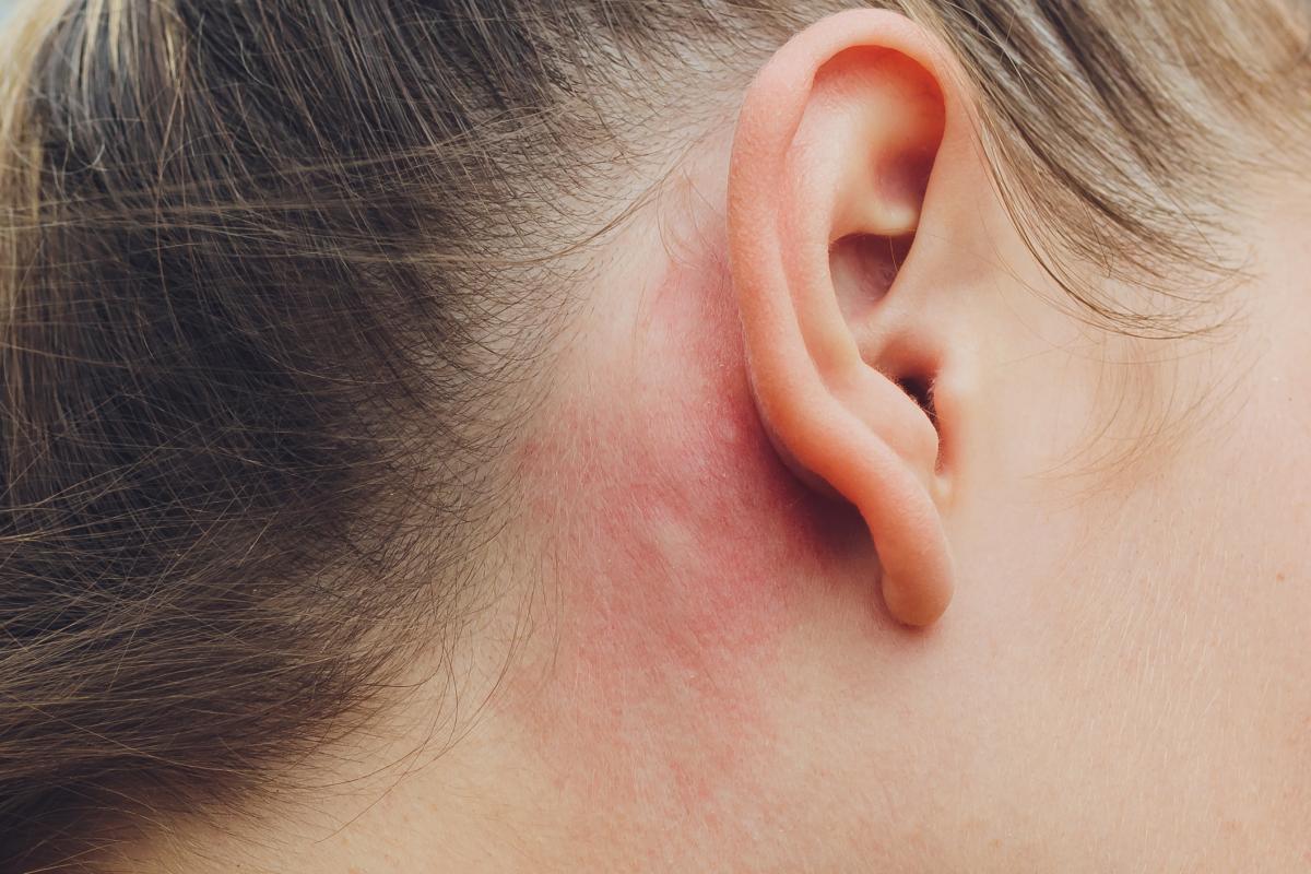 Picor detrás de las orejas: causas y tratamiento