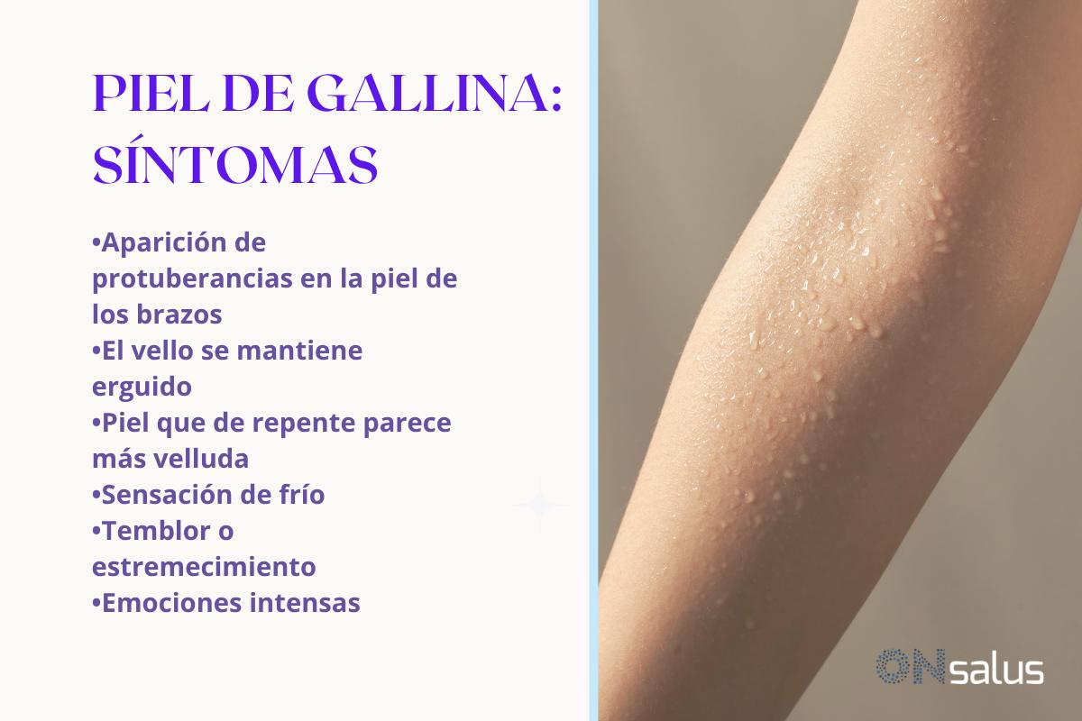 Piel de gallina en los brazos: causas y cómo eliminarla