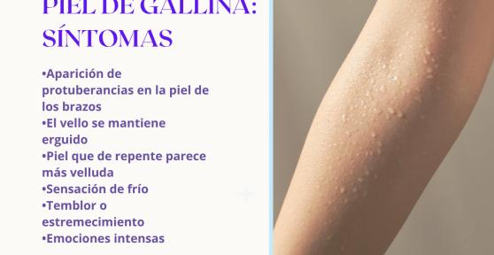 Piel de gallina en los brazos: causas y cómo eliminarla
