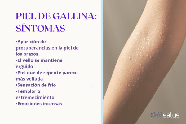 Piel de gallina en los brazos: causas y cómo eliminarla