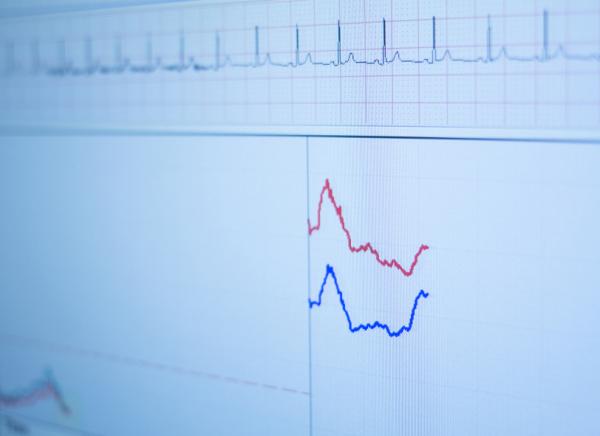 Cardiopatía isquémica: causas, síntomas y tratamiento - Diagnóstico