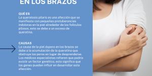 Piel áspera en los brazos: causas y cómo suavizarla