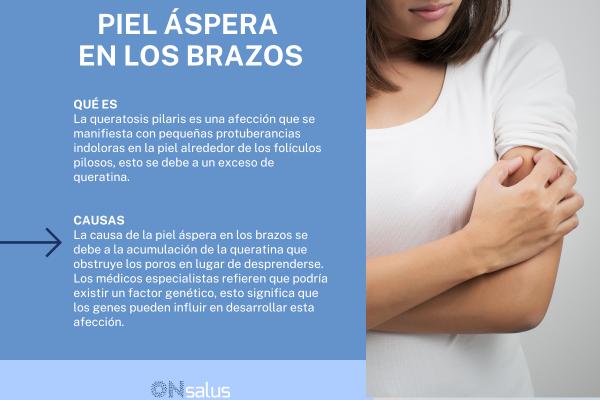 Piel áspera en los brazos: causas y cómo suavizarla