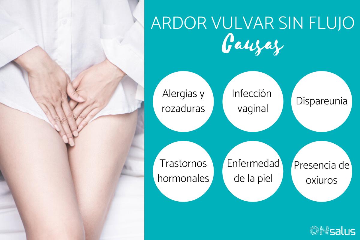 Ardor vulvar sin flujo: causas y tratamiento