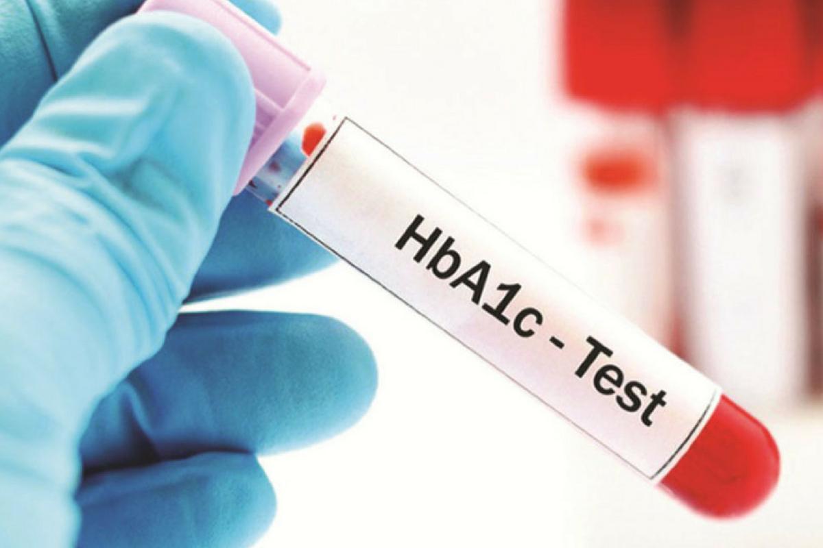 Cómo bajar la hemoglobina glicosilada naturalmente