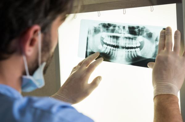 Abfracción dental: qué es y tratamiento