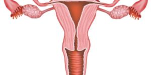 Histerectomía: qué es, riesgos y recuperación