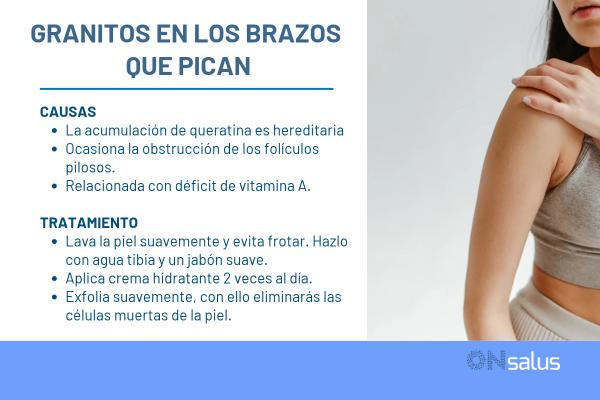 Granitos en los brazos que pican: causas y tratamiento - Causas de los granitos en los brazos que pican