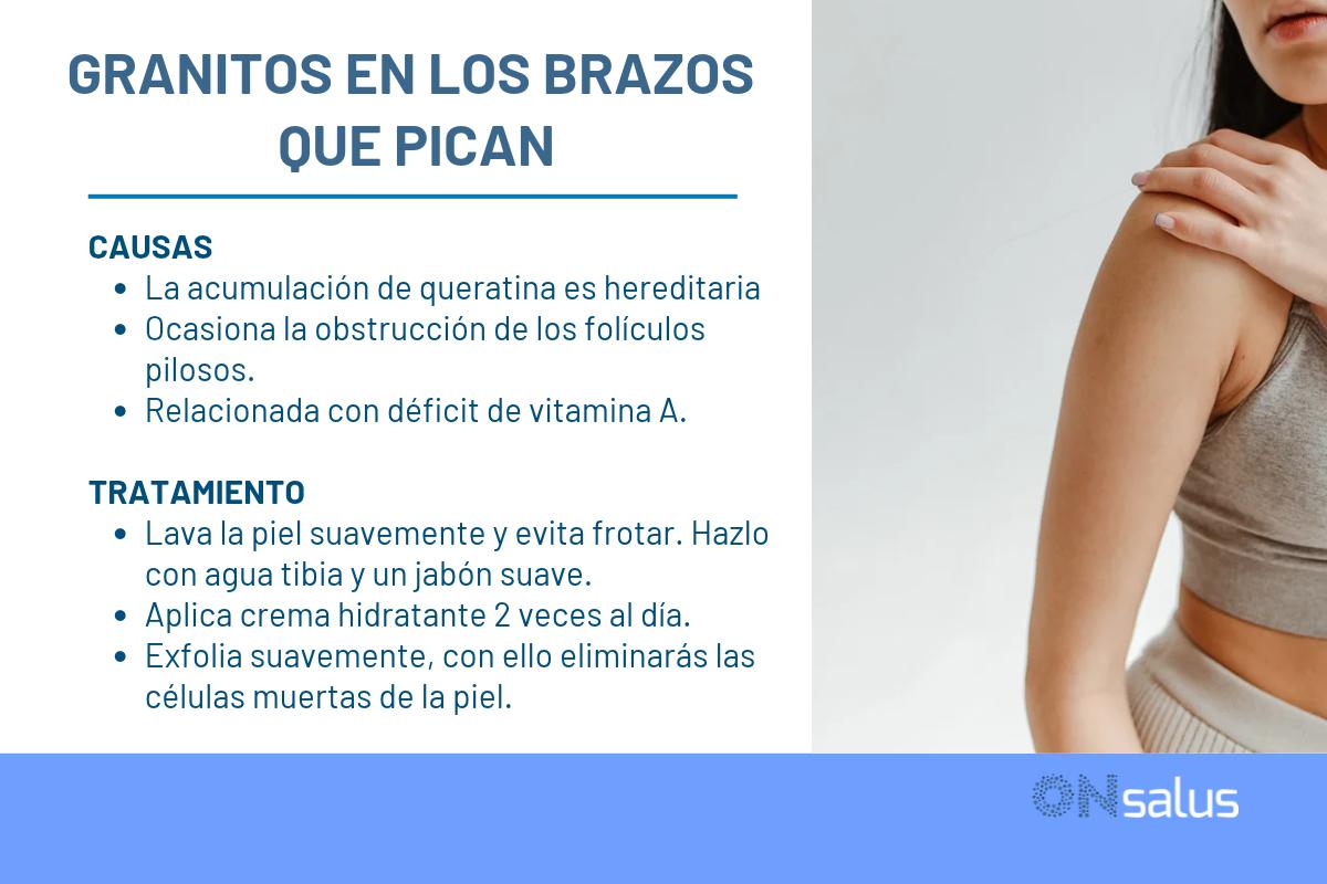 Granitos en los brazos que pican: causas y tratamiento
