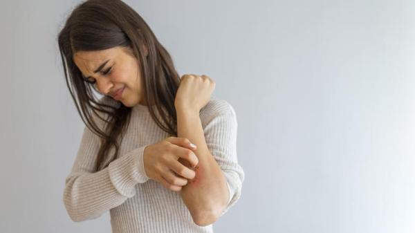 Granitos en los brazos que pican: causas y tratamiento - ¿La queratosis pilaris tiene tratamiento?