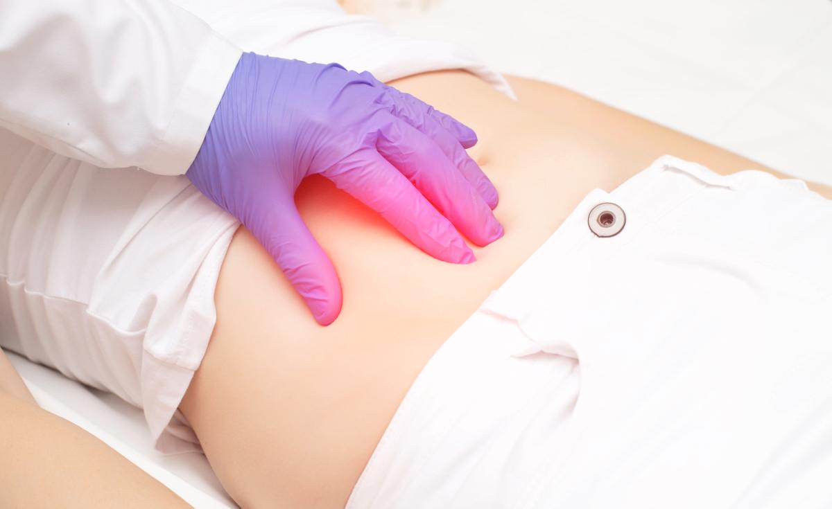 Qué secuelas puede dejar una peritonitis