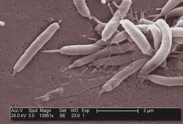 Síntomas de Helicobacter pylori en la boca y la lengua - ¿Qué es la bacteria Helicobacter pylori y cómo afecta a la boca?