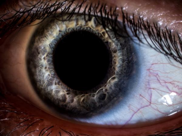 Por qué me escuecen los ojos al llorar - Irritación ocular y cuerpos extraños