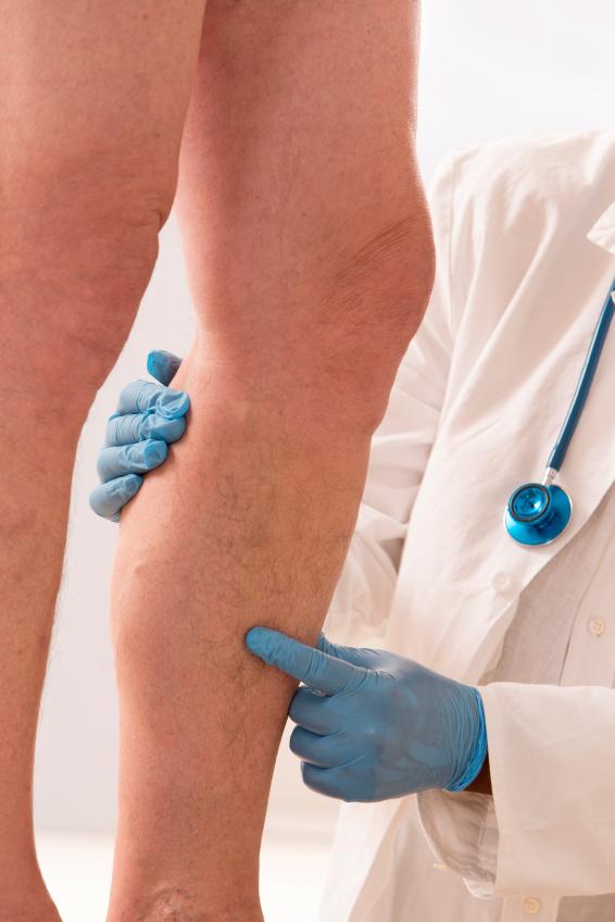 Piernas cansadas: causas, síntomas y remedios - Causas de las piernas cansadas