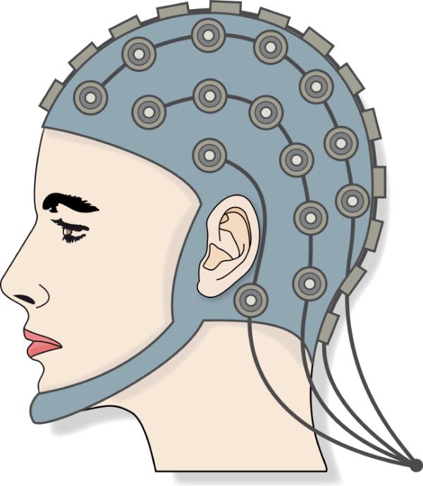 Electroencefalograma: qué es y para qué sirve