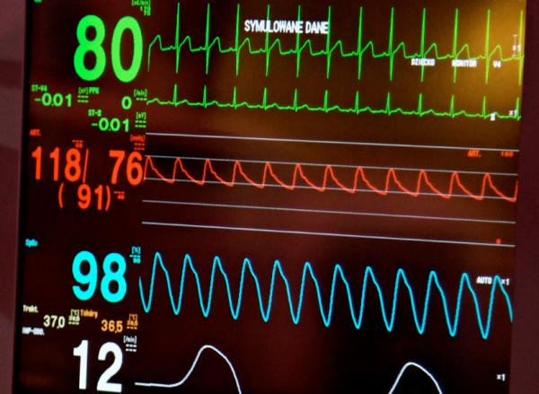 Electroencefalograma: qué es y para qué sirve - Resultados anormales de un electroencefalograma