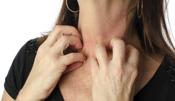 10 síntomas del cáncer que deberías conocer - Heridas que no cicatrizan