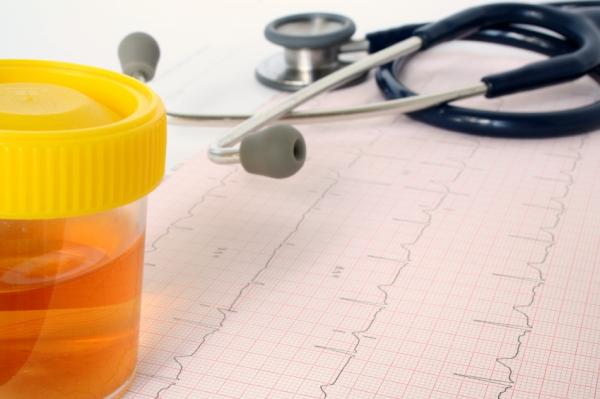 10 síntomas del cáncer que deberías conocer - Problemas en la orina