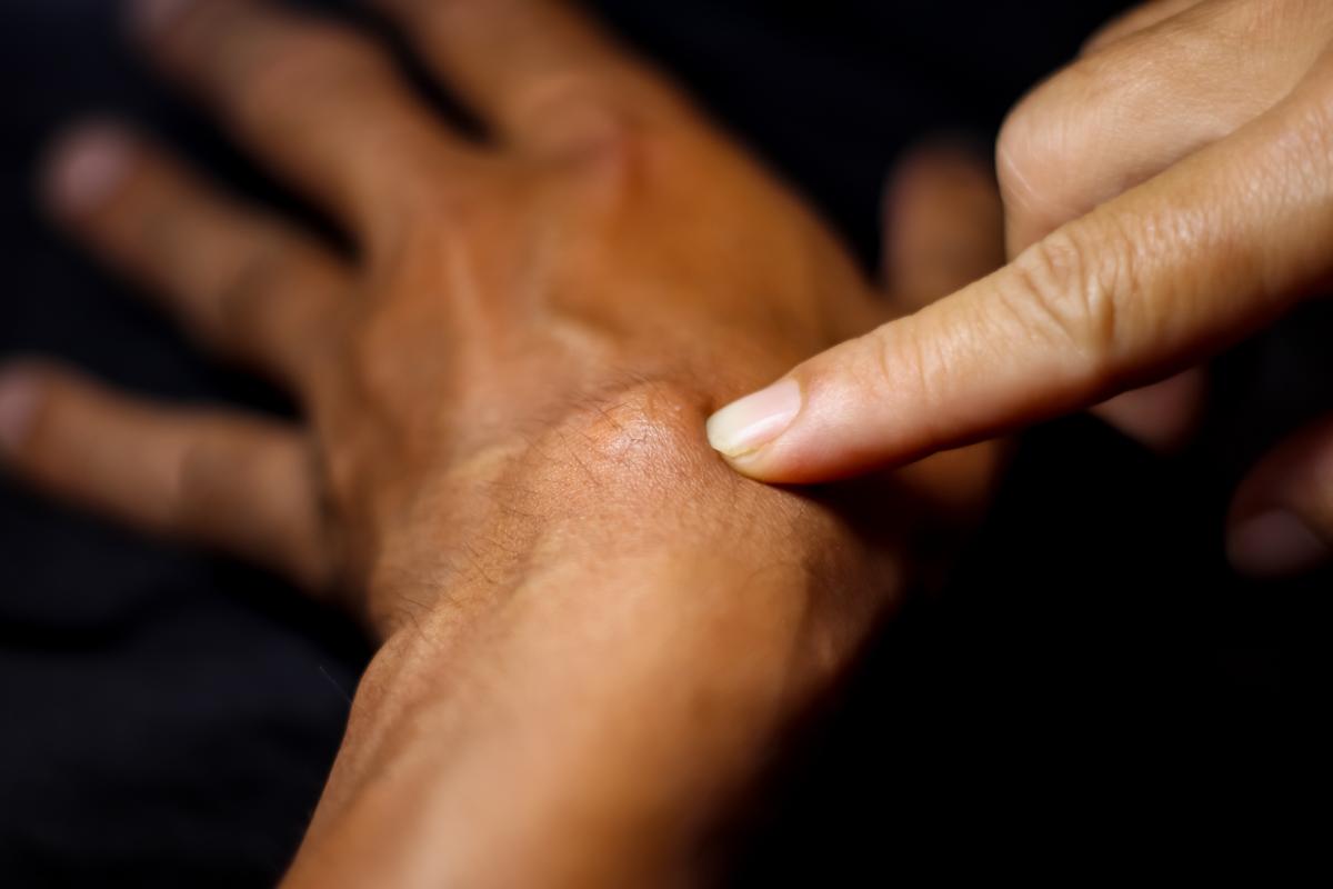 Bulto duro en la muñeca con dolor: causas y tratamiento