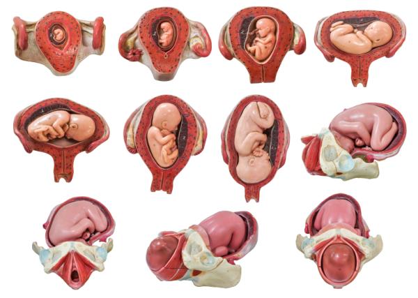 Consejos para prevenir la macrosomía fetal - Causas de la macrosomía fetal