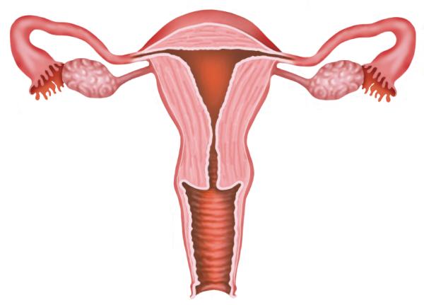 Flujo marrón antes de la regla - Ectopia cervical