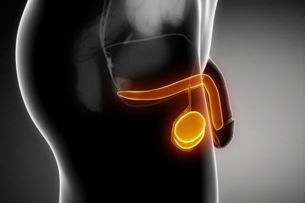 Testículo inflamado y duro: causas y tratamiento