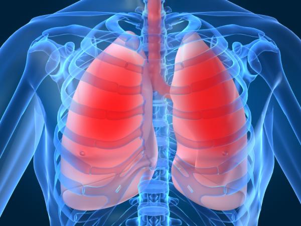 Posibles secuelas de una trombosis pulmonar